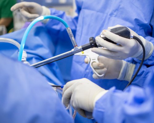 Arthroscopic (Keyhole) Procedure