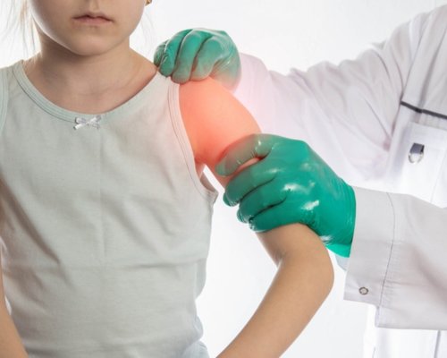 Pediatric Fracture Treatment