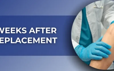 What to Expect Eight Weeks After Knee Replacement