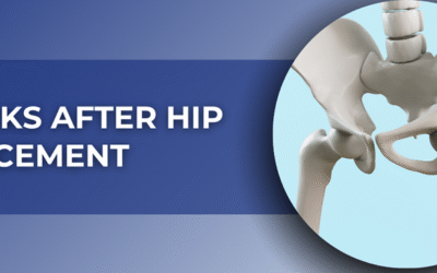 12 Weeks After Hip Replacement