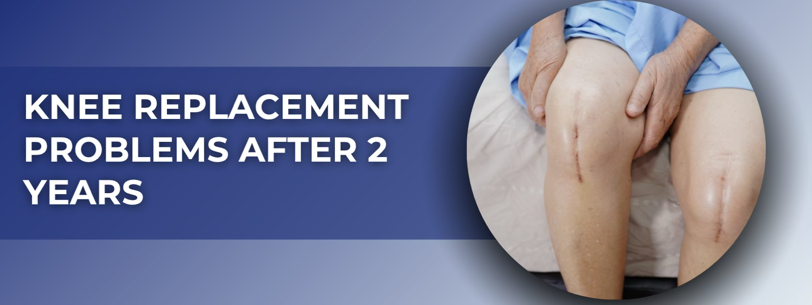 Hip Replacement in Akshayanagar, Bangalore