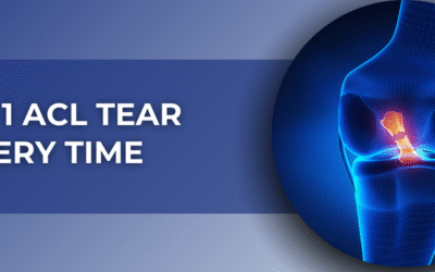 Grade 1 ACL Tear Recovery Time – What You Need to Know