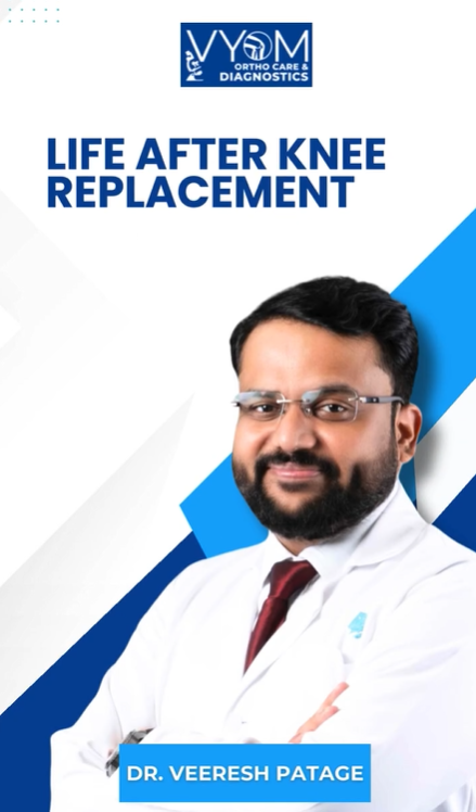 Life After Knee Replacement thumbnail