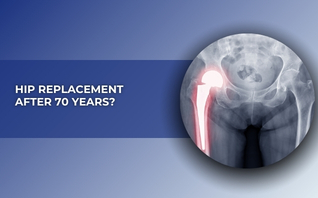 How Long Does Titanium Hip Replacement Last? Dr. Patage
