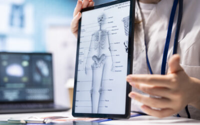 Why More Patients Are Choosing Robotic Knee and Hip Replacement