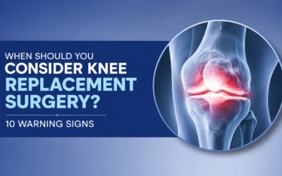 When Should You Consider Knee Replacement Surgery? 10 Warning Signs